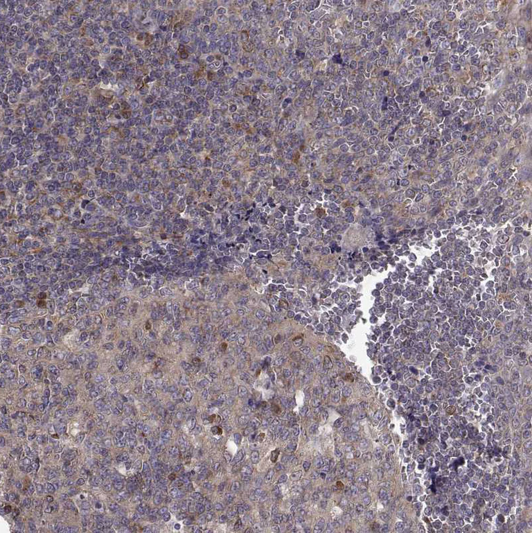 Immunohistochemistry (Formalin/PFA-fixed paraffin-embedded sections) - Anti-ARFGAP1 antibody (AB204405)
