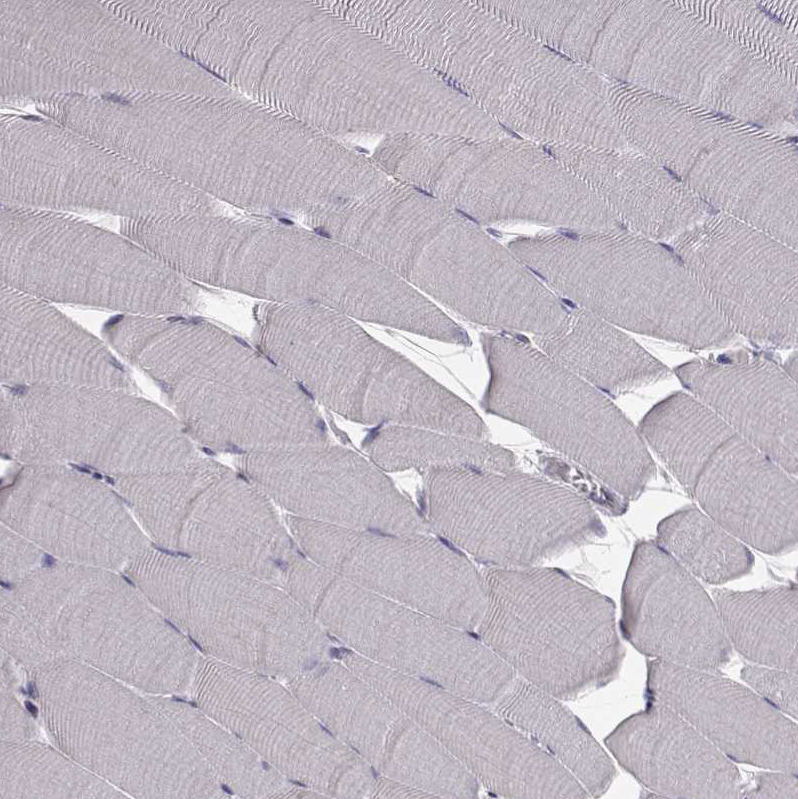 Immunohistochemistry (Formalin/PFA-fixed paraffin-embedded sections) - Anti-ARFGAP1 antibody (AB204405)