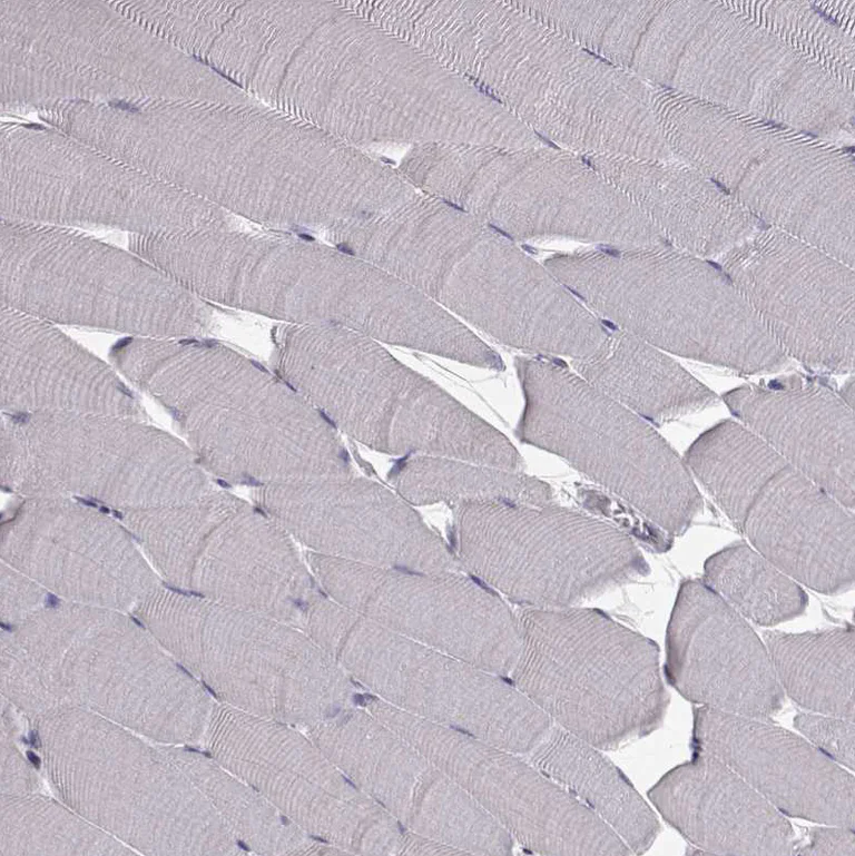 Immunohistochemistry (Formalin/PFA-fixed paraffin-embedded sections) - Anti-ARFGAP1 antibody (AB204405)