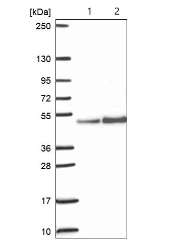 Western blot - Anti-ARFGAP1 antibody (AB204405)