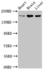 Western blot - Anti-ARFGEF2/BIG2 antibody (AB236951)