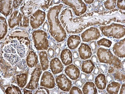 Immunohistochemistry (Formalin/PFA-fixed paraffin-embedded sections) - Anti-Arg2 antibody (AB228700)
