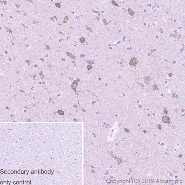 Immunohistochemistry (Formalin/PFA-fixed paraffin-embedded sections) - Anti-Arg2 antibody [EPR22626-38] (AB264066)