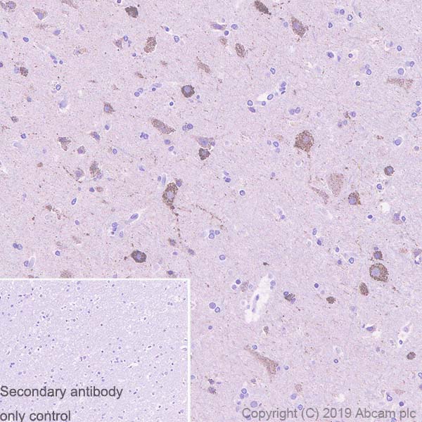 Immunohistochemistry (Formalin/PFA-fixed paraffin-embedded sections) - Anti-Arg2 antibody [EPR22626-38] - BSA and Azide free (AB264071)