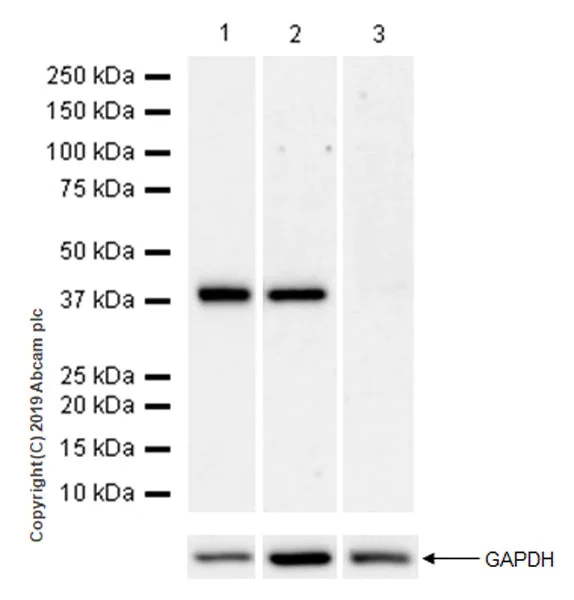 Western blot - Anti-Arg2 antibody [EPR22626-51] (AB228963)