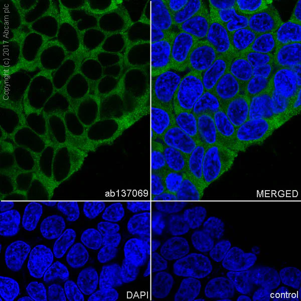 Immunocytochemistry/ Immunofluorescence - Anti-Arg2 antibody [EPR9473] (AB137069)