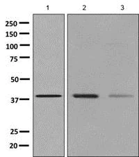 Western blot - Anti-Arg2 antibody [EPR9473] (AB137069)