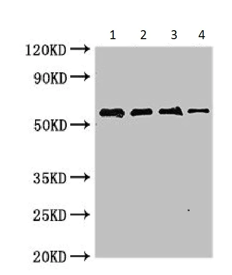 Western blot - Anti-Arginine kinase antibody (AB225937)