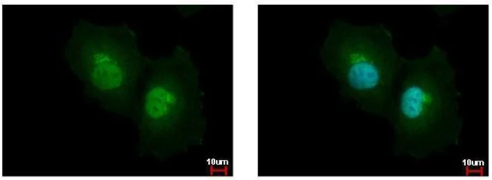 Immunocytochemistry/ Immunofluorescence - Anti-Argininosuccinate Lyase antibody (AB96215)