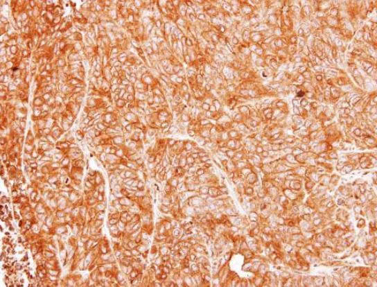 Immunohistochemistry (Formalin/PFA-fixed paraffin-embedded sections) - Anti-Argininosuccinate Lyase antibody (AB96215)