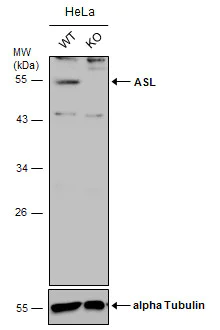 Western blot - Anti-Argininosuccinate Lyase antibody (AB96215)