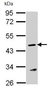 Western blot - Anti-Argininosuccinate Lyase antibody (AB96215)