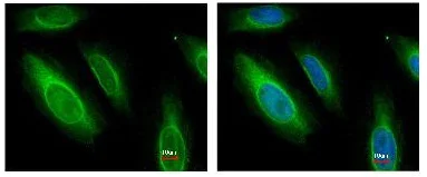 Immunocytochemistry/ Immunofluorescence - Anti-Argininosuccinate Lyase antibody (AB97370)