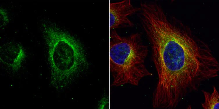 Immunocytochemistry/ Immunofluorescence - Anti-Argininosuccinate Lyase antibody (AB97370)
