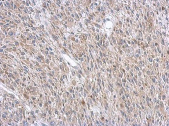 Immunohistochemistry (Formalin/PFA-fixed paraffin-embedded sections) - Anti-Argininosuccinate Lyase antibody (AB97370), expandable thumbnail