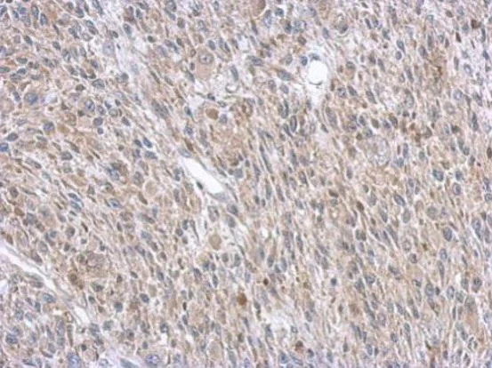 Immunohistochemistry (Formalin/PFA-fixed paraffin-embedded sections) - Anti-Argininosuccinate Lyase antibody (AB97370)
