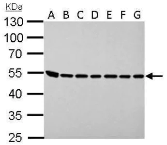 Western blot - Anti-Argininosuccinate Lyase antibody (AB97370)