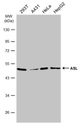 Western blot - Anti-Argininosuccinate Lyase antibody (AB97370), expandable thumbnail