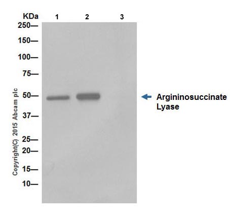 Immunoprecipitation - Anti-Argininosuccinate Lyase antibody [EPR19382] (AB201025)