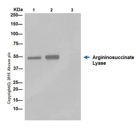 Immunoprecipitation - Anti-Argininosuccinate Lyase antibody [EPR19382] - BSA and Azide free (AB251330)