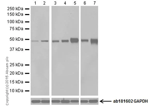 Western blot - Anti-Argininosuccinate Lyase antibody [EPR19382] - BSA and Azide free (AB251330)