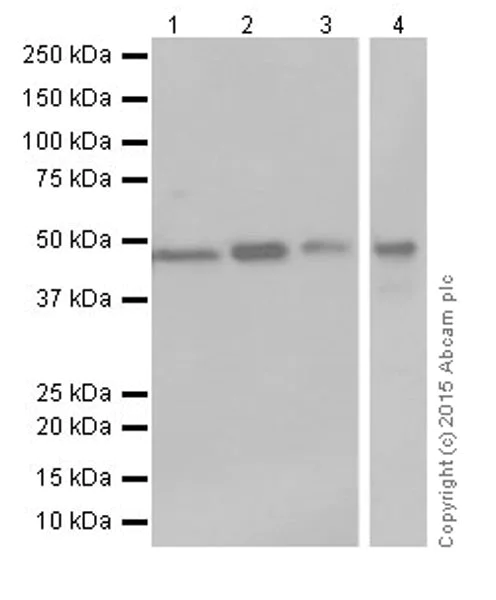 Western blot - Anti-Argininosuccinate Lyase antibody [EPR19382] - BSA and Azide free (AB251330)