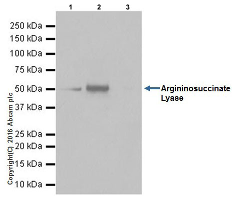 Immunoprecipitation - Anti-Argininosuccinate Lyase antibody [EPR19396] (AB201026), expandable thumbnail