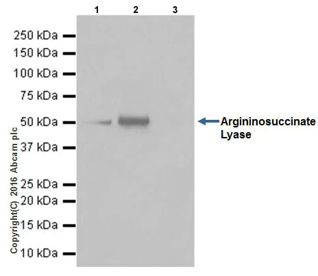Immunoprecipitation - Anti-Argininosuccinate Lyase antibody [EPR19396] (AB201026)