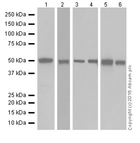 Western blot - Anti-Argininosuccinate Lyase antibody [EPR19396] (AB201026), expandable thumbnail