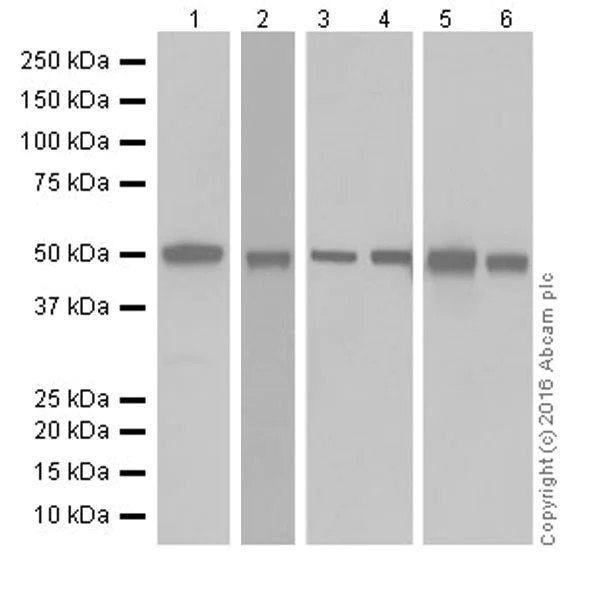 Western blot - Anti-Argininosuccinate Lyase antibody [EPR19396] (AB201026)