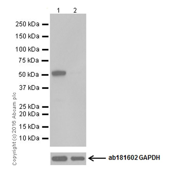 Western blot - Anti-Argininosuccinate Lyase antibody [EPR19396] (AB201026), expandable thumbnail