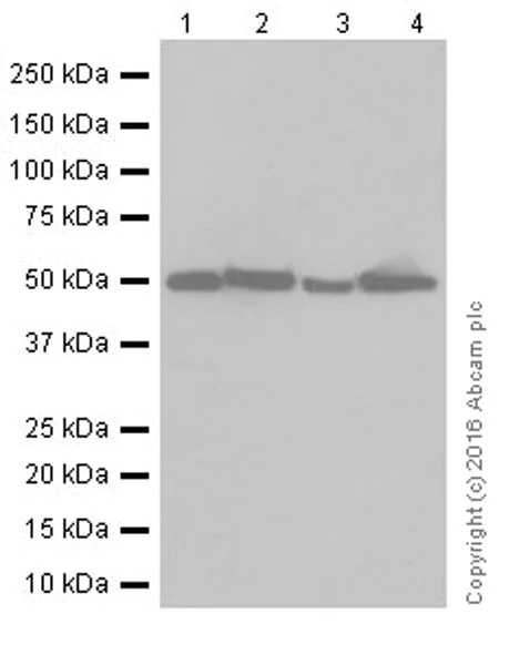 Western blot - Anti-Argininosuccinate Lyase antibody [EPR19396] - BSA and Azide free (AB251331)