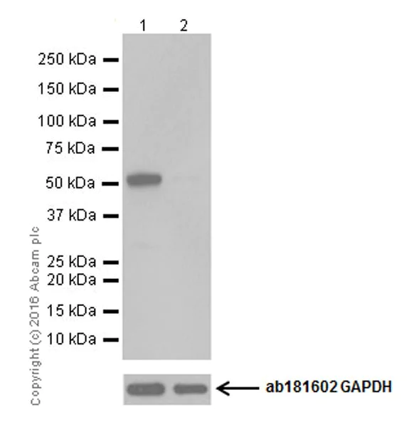 Western blot - Anti-Argininosuccinate Lyase antibody [EPR19396] - BSA and Azide free (AB251331)