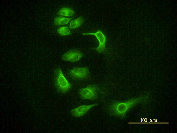 Immunocytochemistry/ Immunofluorescence - Anti-Argonaute-2 antibody [2E12-1C9] - BSA and Azide free (AB57113), expandable thumbnail