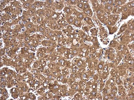 Immunohistochemistry (Formalin/PFA-fixed paraffin-embedded sections) - Anti-Argonaute-2 antibody (AB226943)