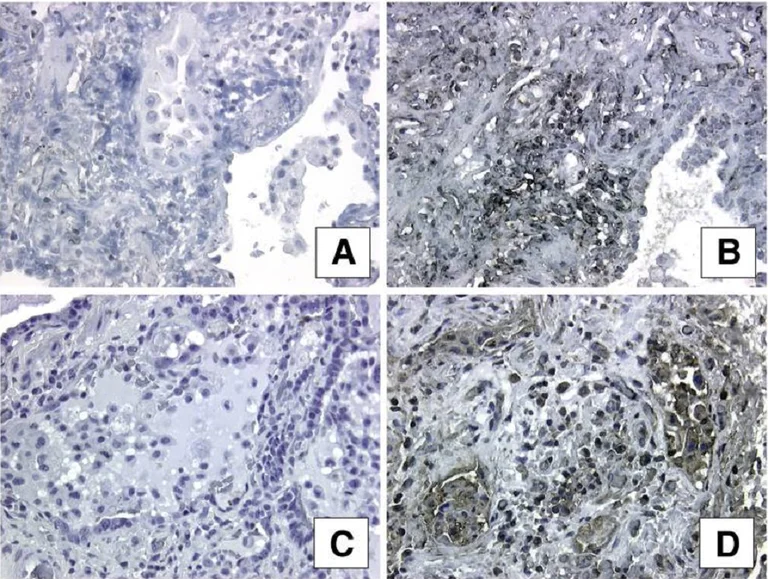 Immunohistochemistry (Formalin/PFA-fixed paraffin-embedded sections) - Anti-Argonaute-2 antibody (AB32381)