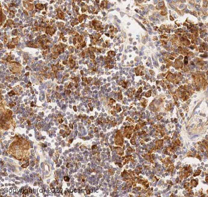 Immunohistochemistry (Formalin/PFA-fixed paraffin-embedded sections) - Anti-Argonaute-2 antibody (AB32381)