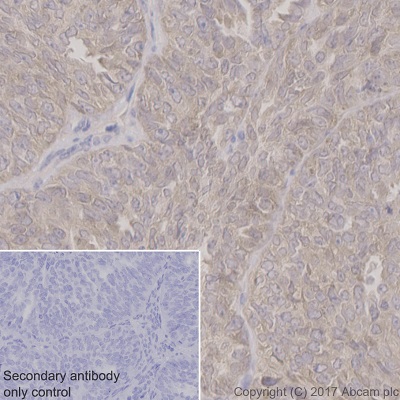 Immunohistochemistry (Formalin/PFA-fixed paraffin-embedded sections) - Anti-Argonaute-2 antibody [EPR10410] (AB156870), expandable thumbnail