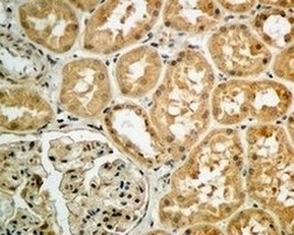 Immunohistochemistry (Formalin/PFA-fixed paraffin-embedded sections) - Anti-Argonaute-2 antibody [EPR10410] (AB156870), expandable thumbnail
