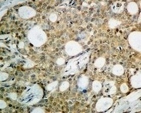 Immunohistochemistry (Formalin/PFA-fixed paraffin-embedded sections) - Anti-Argonaute-2 antibody [EPR10410] (ab156870), expandable thumbnail
