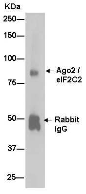 Immunoprecipitation - Anti-Argonaute-2 antibody [EPR10411] (AB186733)