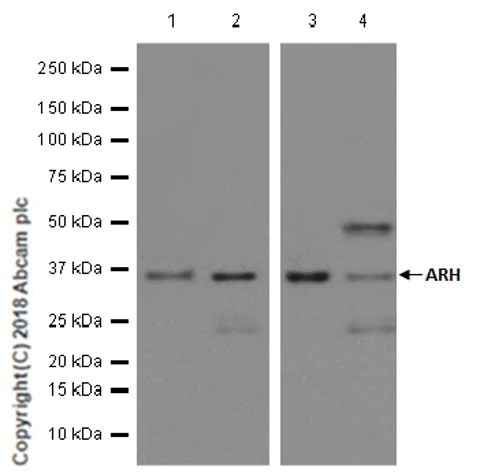 Western blot - Anti-ARH antibody [EPR13115] - BSA and Azide free (AB250304)