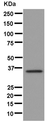 Western blot - Anti-ARH antibody [EPR13115] - BSA and Azide free (AB250304)