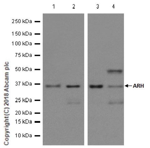 Western blot - Anti-ARH antibody [EPR13115] - N-terminal (AB181043)
