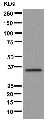 Western blot - Anti-ARH antibody [EPR13115] - N-terminal (AB181043)