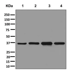 Western blot - Anti-ARH antibody [EPR13116] - BSA and Azide free (AB250127)
