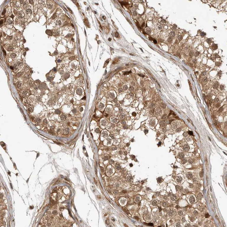 Immunohistochemistry (Formalin/PFA-fixed paraffin-embedded sections) - Anti-ARH3 antibody (AB224751)