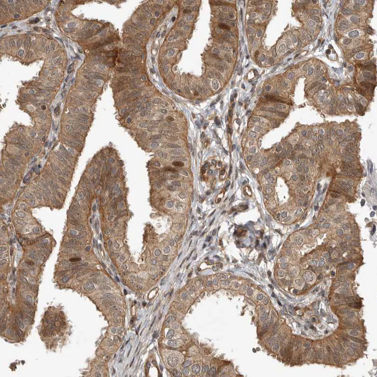 Immunohistochemistry (Formalin/PFA-fixed paraffin-embedded sections) - Anti-ARH3 antibody (AB224751)