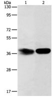 Western blot - Anti-ARH3 antibody - C-terminal (AB199171)