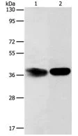 Western blot - Anti-ARH3 antibody - C-terminal (AB199171)